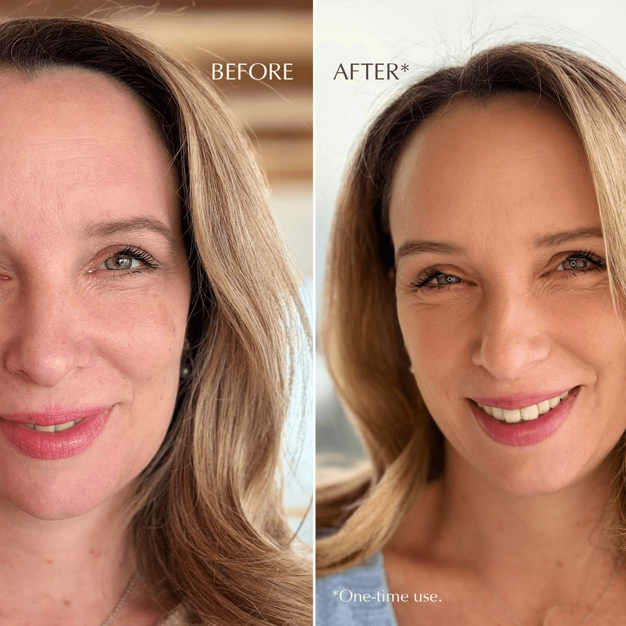 Face – Lifting Booster