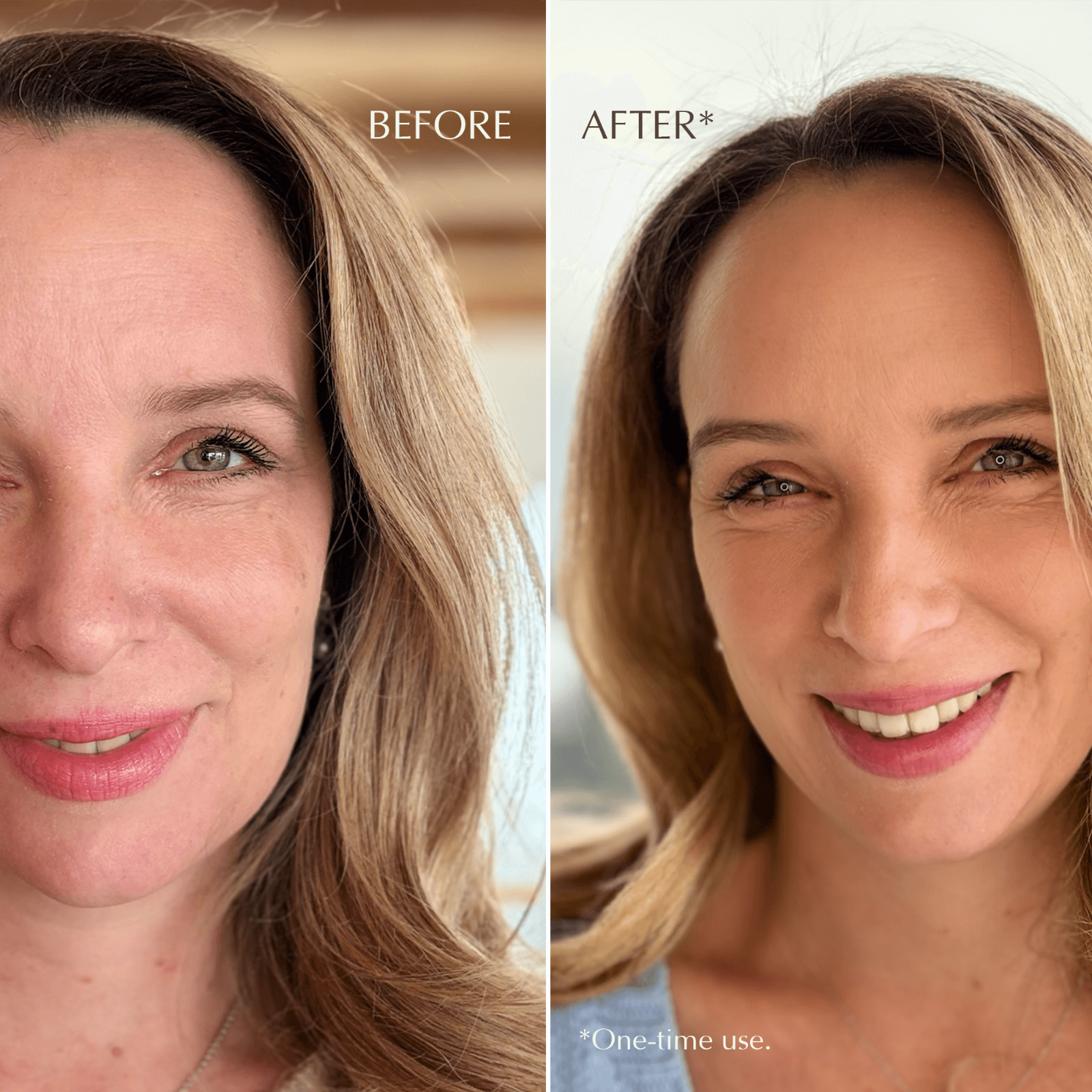Before and after comparison of a woman’s face showing smoother, glowing skin and reduced fine lines after one use of JK7 Skincare.
