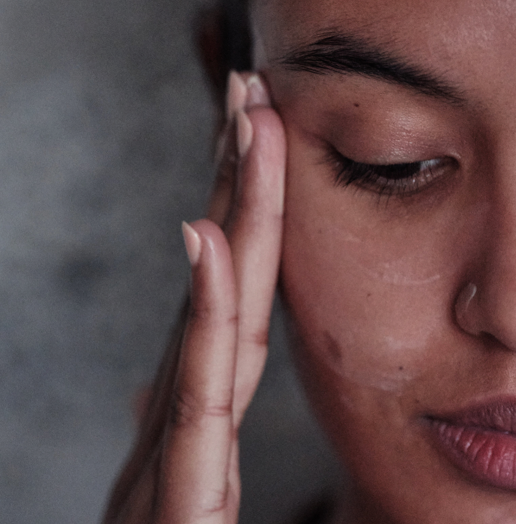 What Are Dehydration Lines and How Can You Naturally Smooth Them?