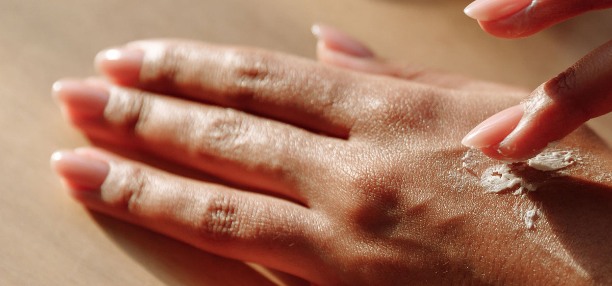 A close-up of a hand receiving a skin treatment, with another hand applying a clear cream or gel onto the back of the hand.